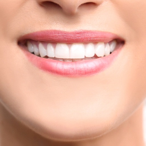 A closeup of a patient that’s received cosmetic bonding in Winfield, KS