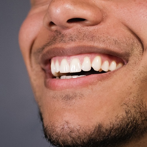 Close-up of a man with a gummy smile
