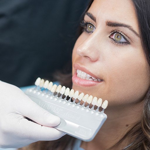 Woman's smile compared to porcelain veneer color chart