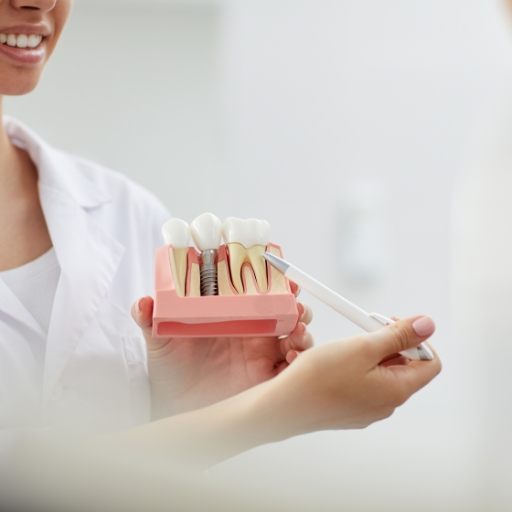 Dentist showing patient a dental implant model