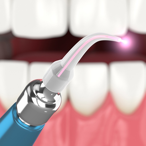 Patient receiving soft tissue laser dentistry treatment