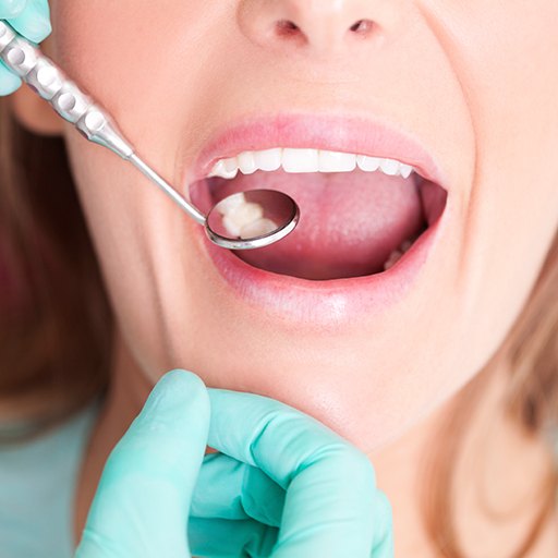 Dentist checking patien's tooth colored filling during restorative dentistry visit