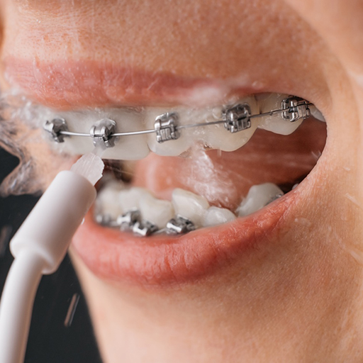 woman using water flosser traditional braces in Winfield