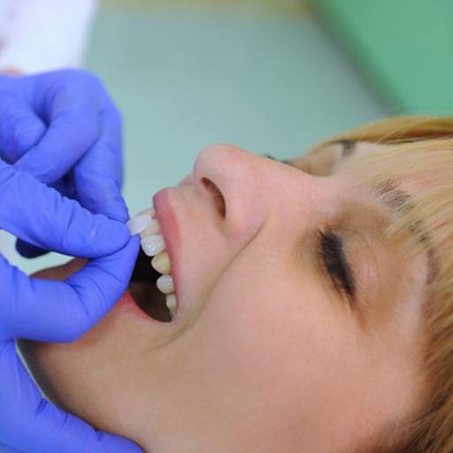 a patient undergoing the veneer process