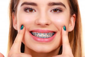 teen with metal braces 