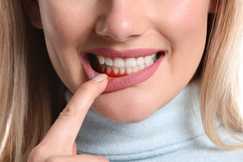 a woman showing symptoms of gum disease in Winfield